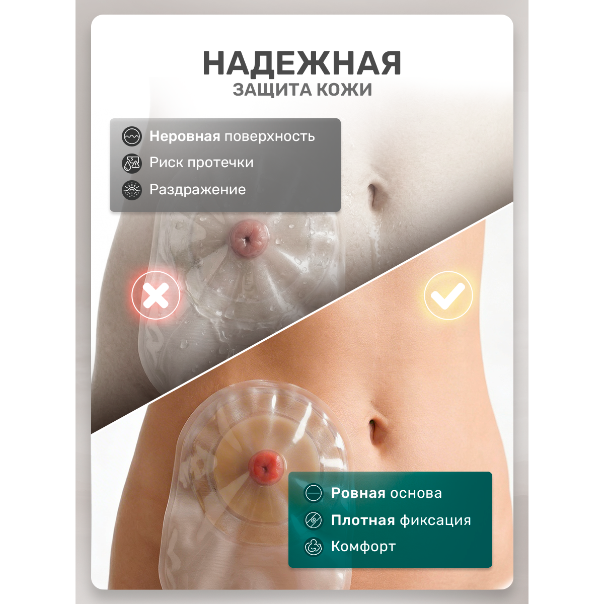 Протектор для стомы многоразовый 4 мм, 1 шт