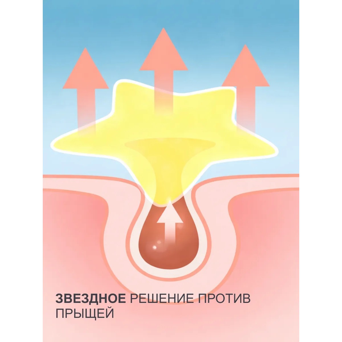 Патчи от прыщей и акне звездочки