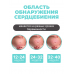 Портативный фетальный допплер 3.0 МГц для домашнего использования