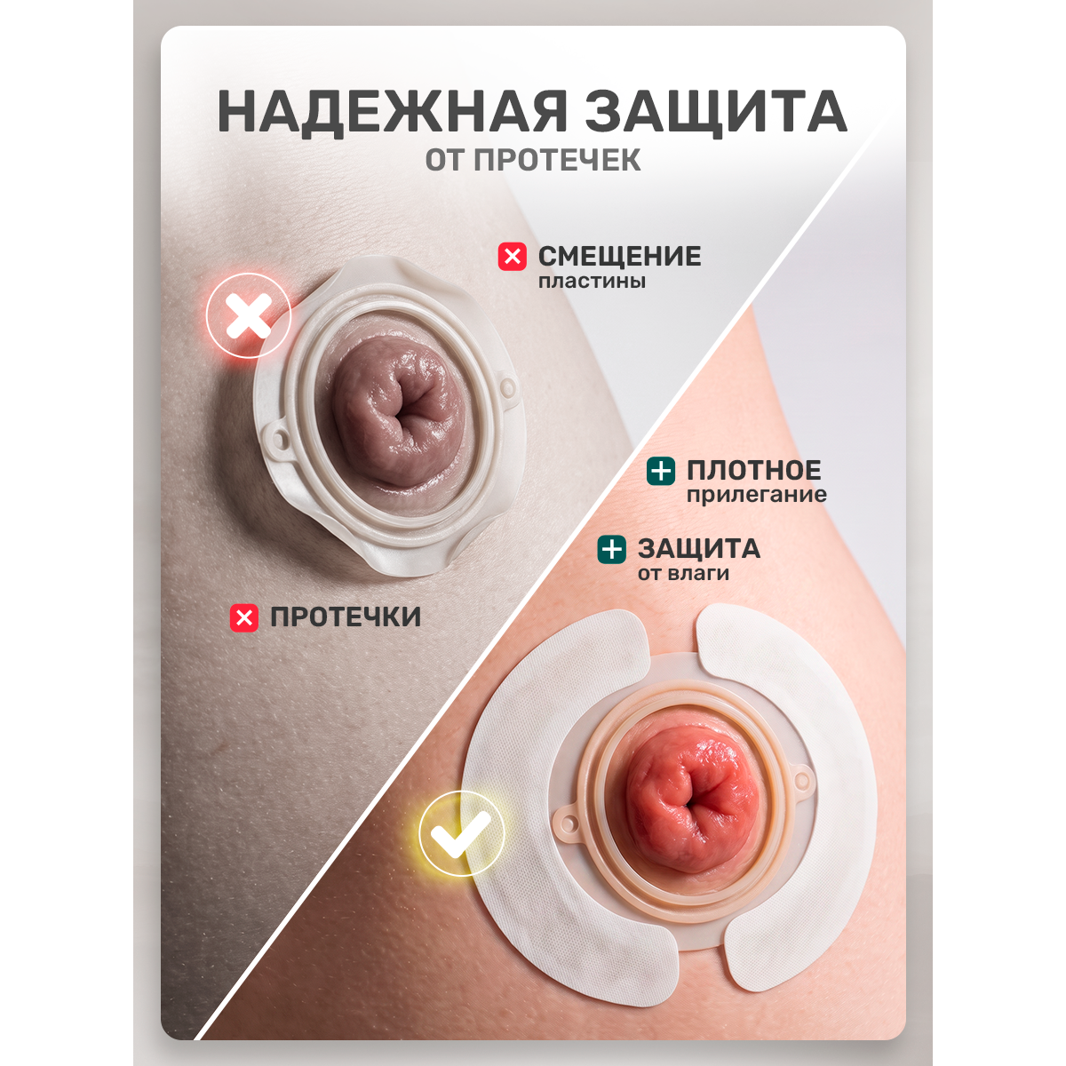 Эластичные пластыри для калоприемника / белый