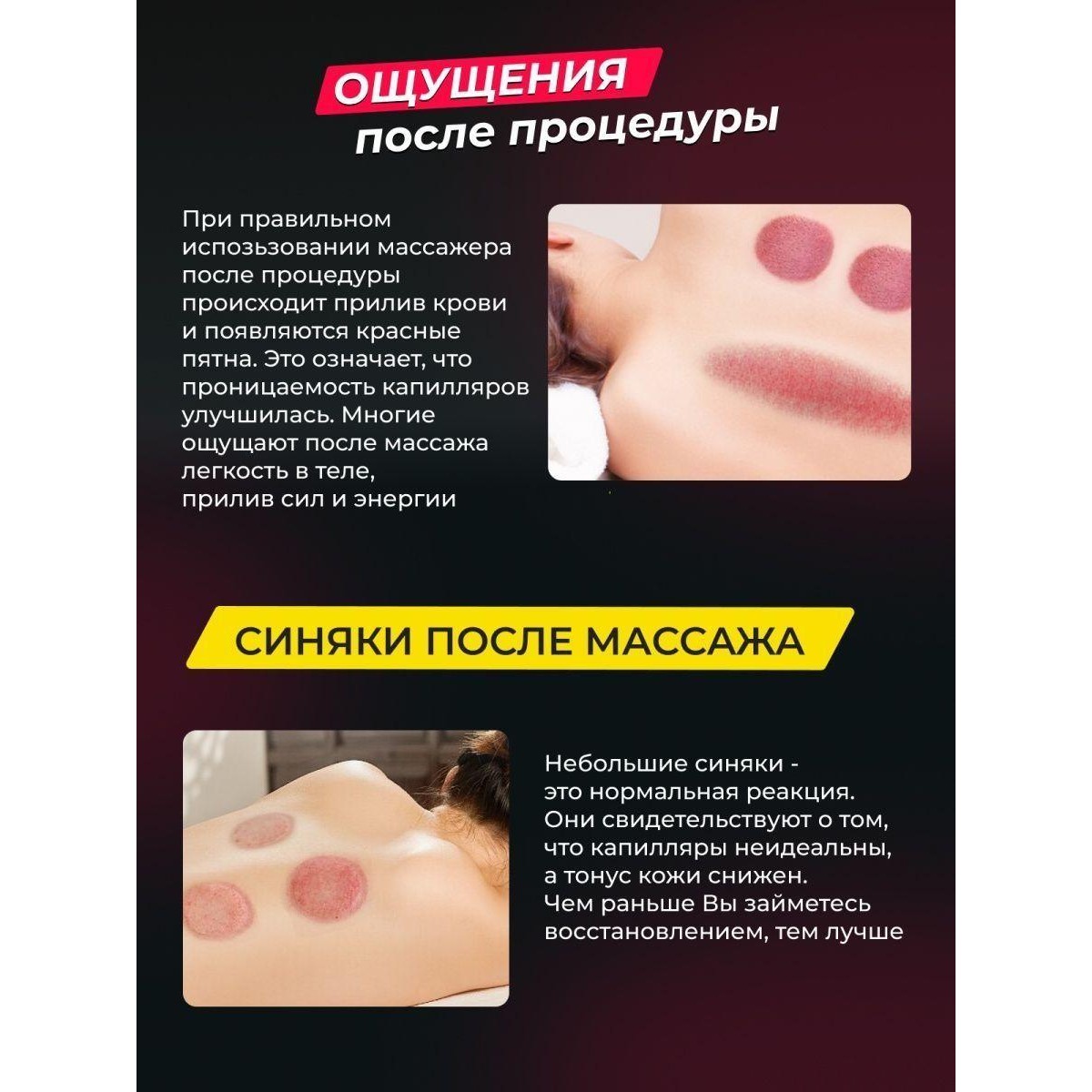 Антицеллюлитный вакуумный массажер банка Intelligent Breathing Cupping Massage Instrument NG-133