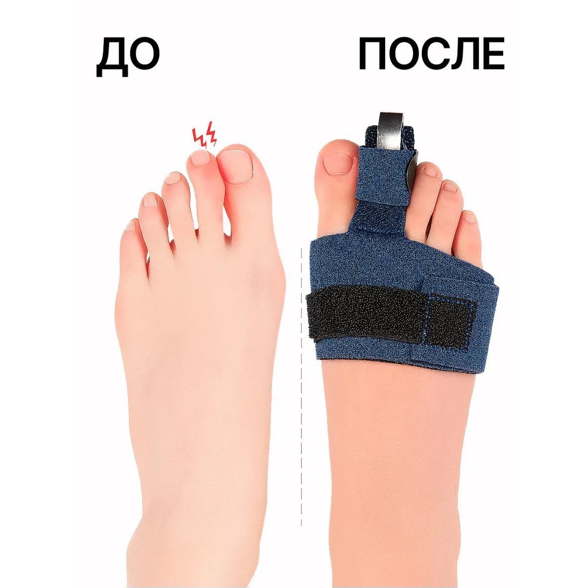 Фиксирующая ортопедическая повязка корректор для пальцев ног / синяя