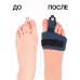 Фиксирующая ортопедическая повязка корректор для пальцев ног / синяя