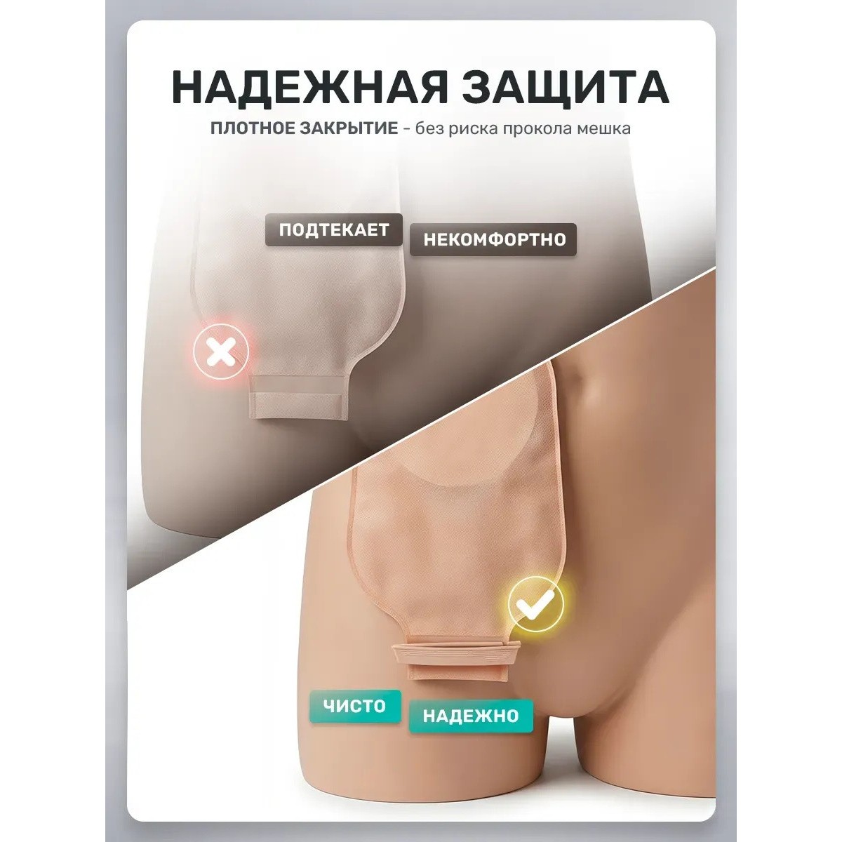 Зажим для фиксации для калоприемного мешка