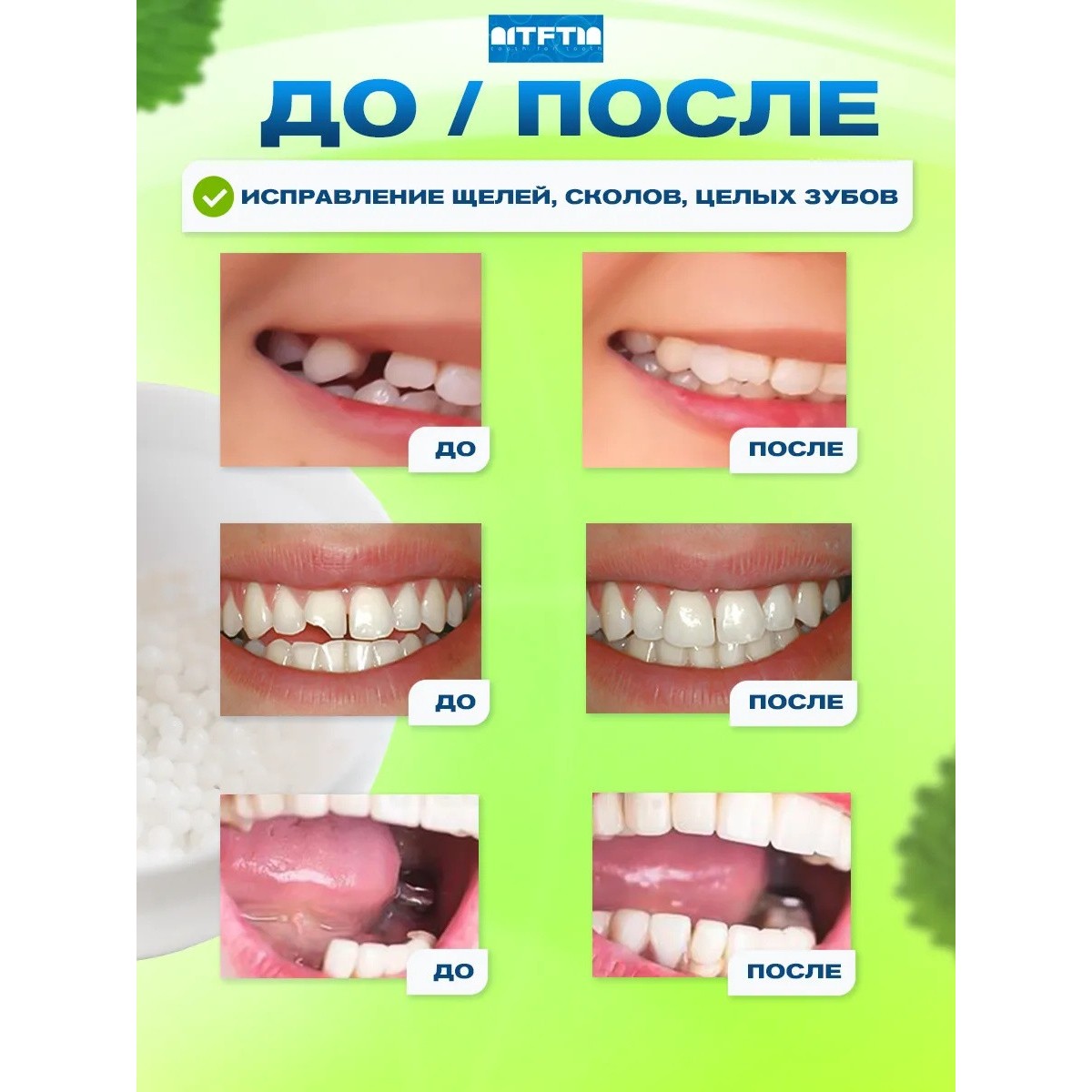Накладные зубы временная пломба виниры, 15 шт