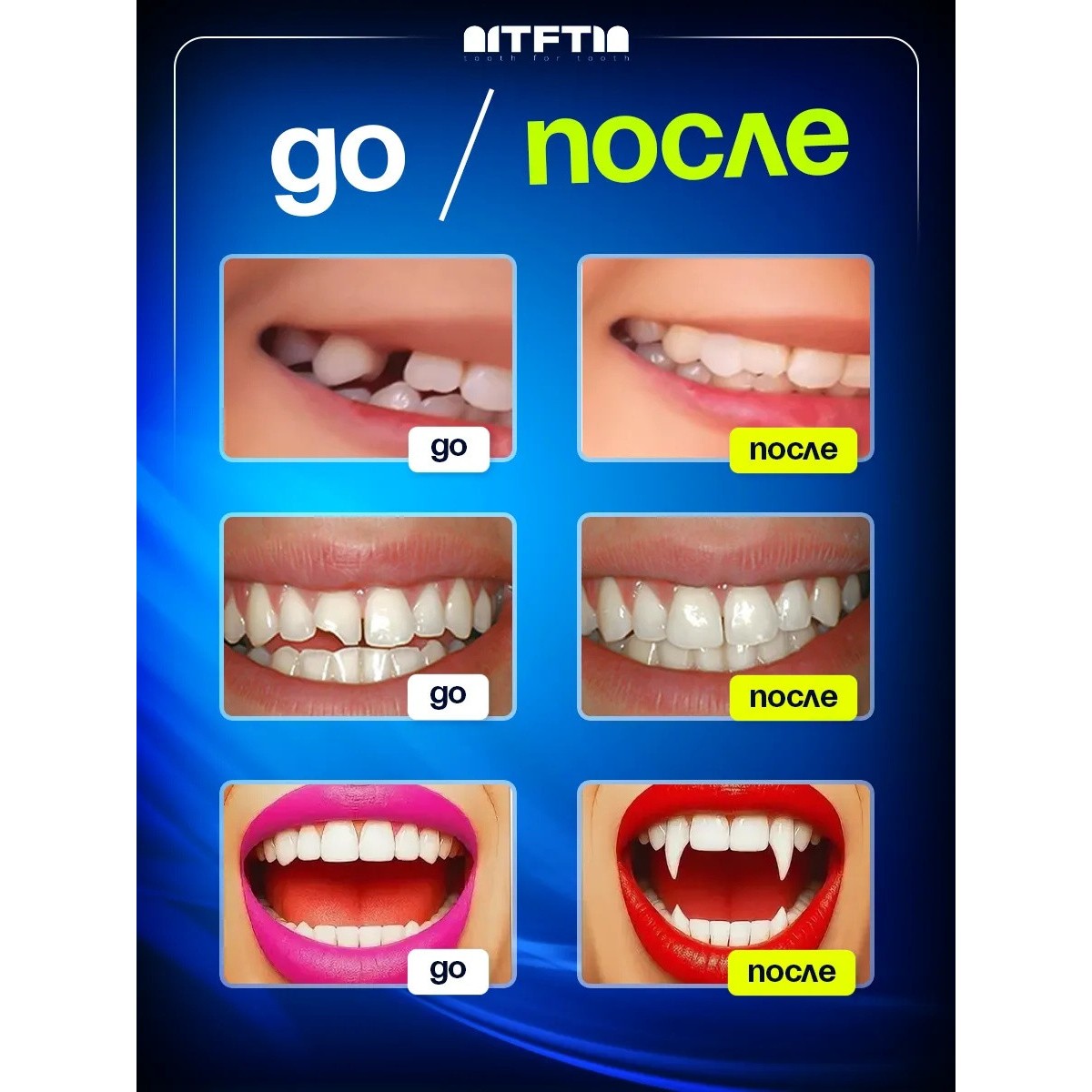 Накладные зубы временная пломба виниры, 30 шт